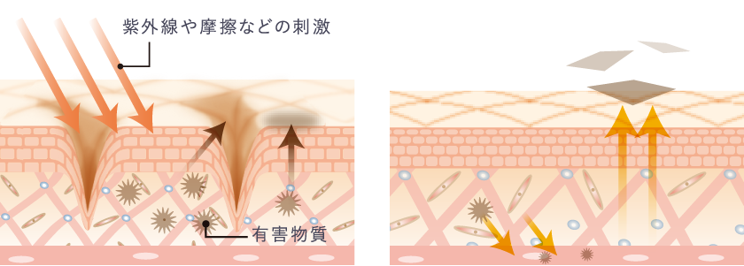 紫外線や摩擦などの刺激